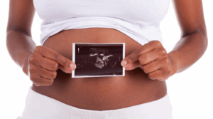 Person holding an ultrasound photo in front of their abdomen, which displays a pregnant belly.