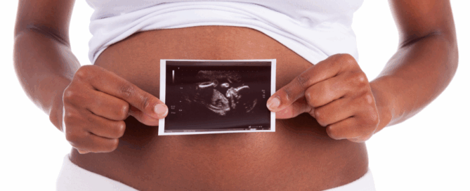 Person holding an ultrasound photo in front of their abdomen, which displays a pregnant belly.