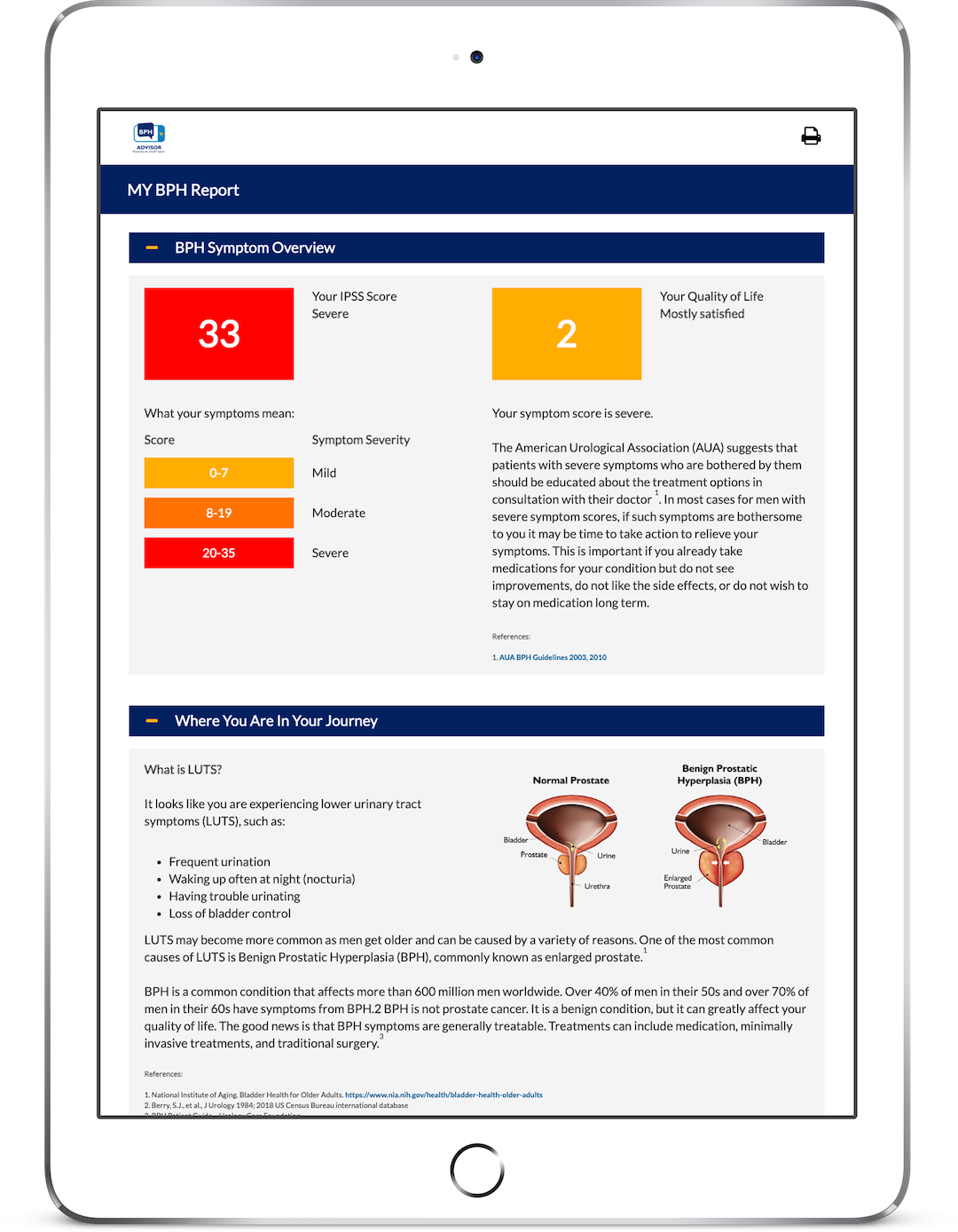 Teleflex myBPH Report™ on Tablet Device GoMo Health